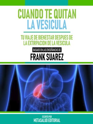 cover image of Cuando Te Quitan La Vesicula--Basado En Las Enseñanzas De Frank Suarez